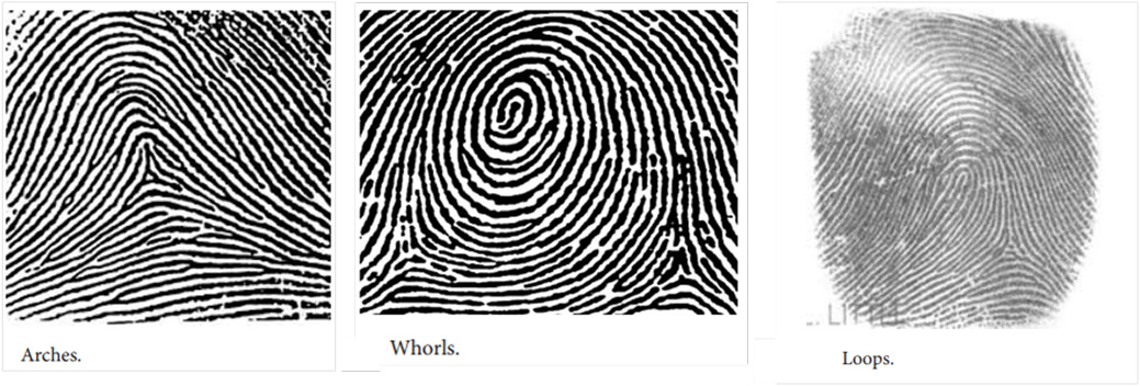 Fingerprint Patterns: Arches, Loops, Whorls